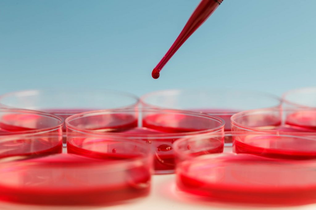 Petri dish samples in a lab