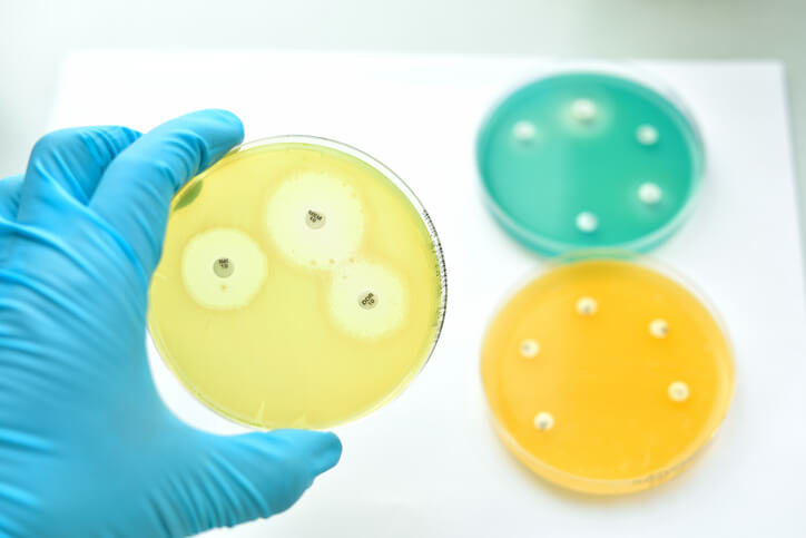 Petri dishes in microbiology laboratory